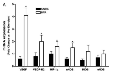 BFR Training May Build New and Better Blood Vessels